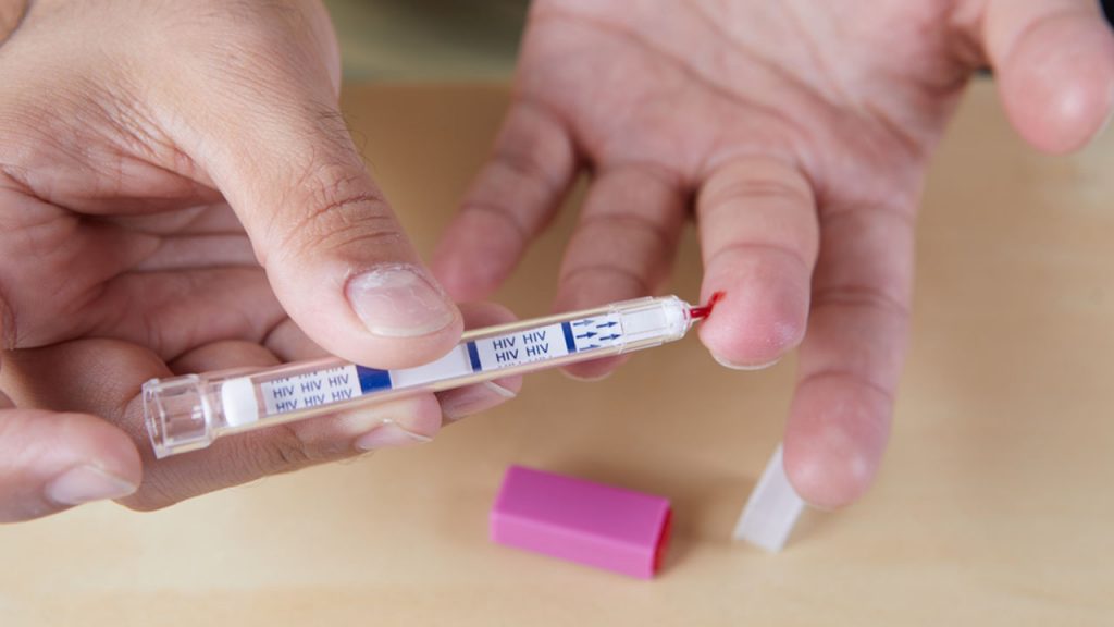What to look for HIV and std testing in Singapore ?