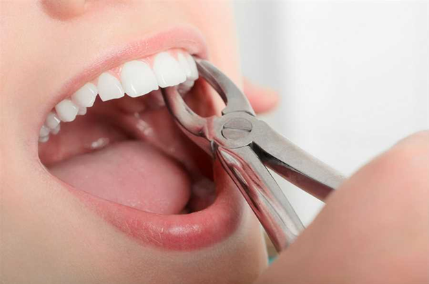 When Are You Recommended to Undergo Oral Surgeries?